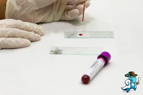 ¿Puedo Ocultar que Tengo Desórdenes Eosinofílicos para Contratar el Seguro Médico en España?