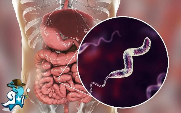 ¿Cubre el Seguro Médico la la Infección por Campylobacter en España?