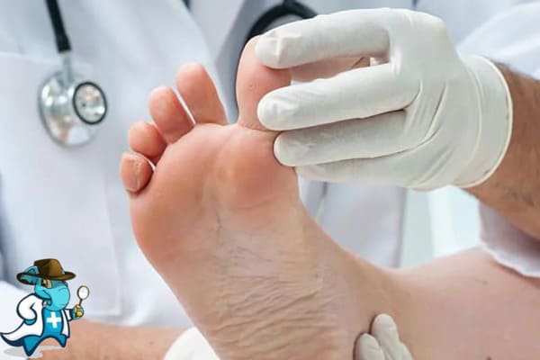 ¿Cubre el Seguro Médico el Pie de Atleta en España?