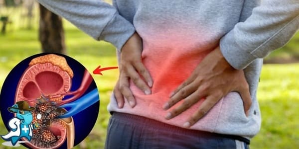 ¿Puedo Contratar un Seguro Médico si Tengo Cáncer de Riñón en España?