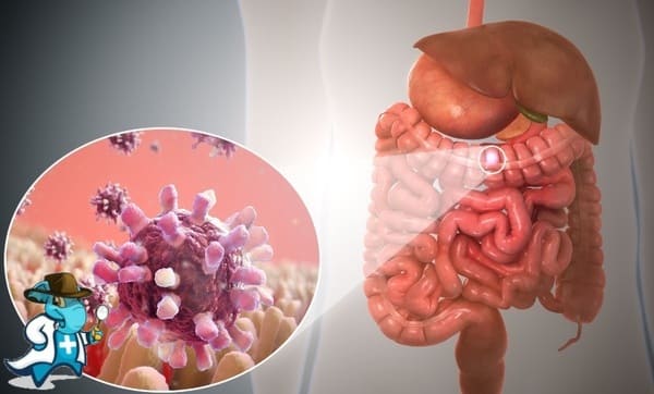 ¿Puedo Ocultar que Tengo una Infección por Campylobacter Para Contratar el Seguro Médico en España?