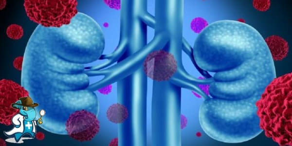 ¿Puedo Ocultar que Tengo Insuficiencia Renal Crónica para Contratar el Seguro Médico en España?