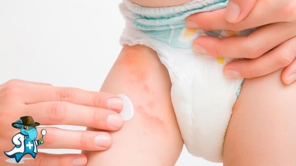 ¿Qué Periodo de Carencia Tiene un Seguro Médico que Cubra la Dermatitis del Pañal en España?