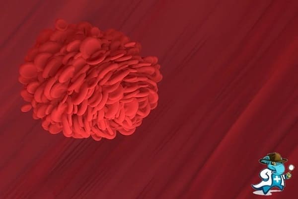 ¿Cubre el Seguro Médico la Hipercoagulabilidad en España?