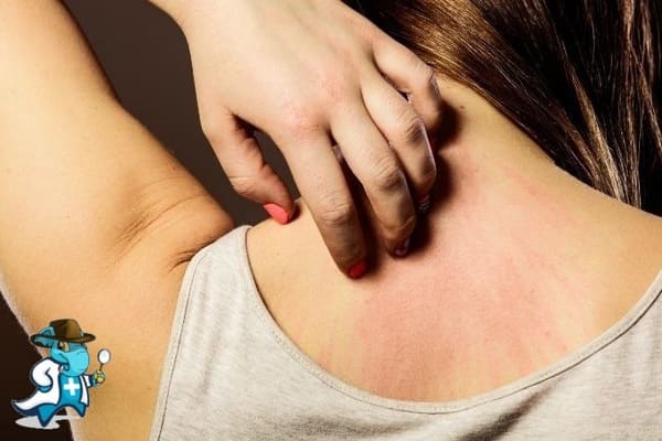 ¿Aumenta el Precio del Seguro Médico para una Persona con una Alergia a la Cebada en España?