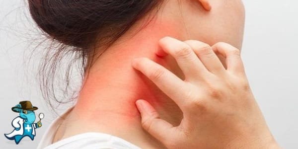 ¿Aumenta el Precio del Seguro Médico para una Persona con una Alergia a los Mariscos en España?