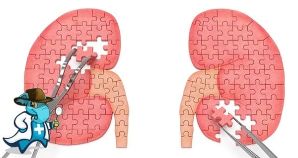 ¿Cubre el Seguro Médico el Síndrome Nefrótico en España?