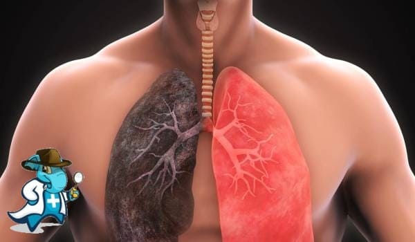 ¿Cubre el Seguro Médico la EPOC en España?
