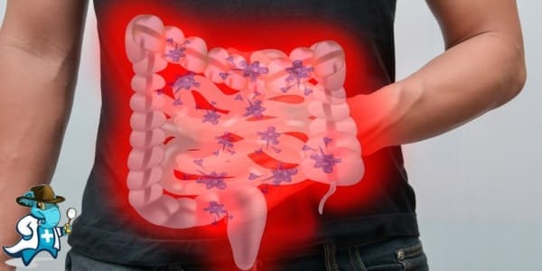 ¿Cubre el Seguro Médico la Enfermedad Celíaca en España?
