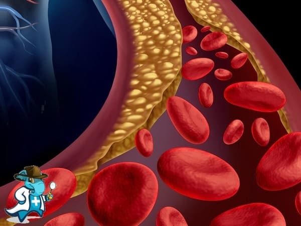 ¿Puedo Contratar un Seguro Médico si Tengo Embolia Pulmonar en España?