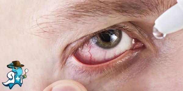 ¿Puedo Contratar un Seguro Médico si Tengo el Ojo Seco en España?