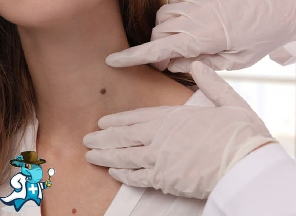 ¿Puedo Contratar un Seguro Médico si Tengo Acrocordones en España?