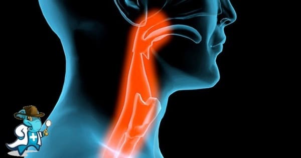 ¿Puedo Ocultar que Tengo Laringitis Para Contratar el Seguro Médico en España?