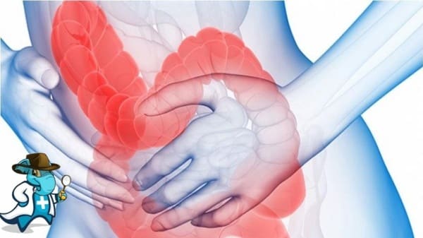 ¿Puedo Ocultar que Tengo Síndrome de Intestino Irritable Para Contratar el Seguro Médico en España?