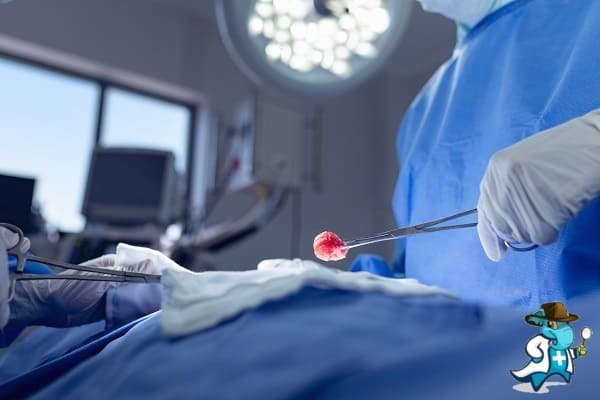¿Puedo Ocultar que Tengo Cálculos Biliares para Contratar el Seguro Médico en España?