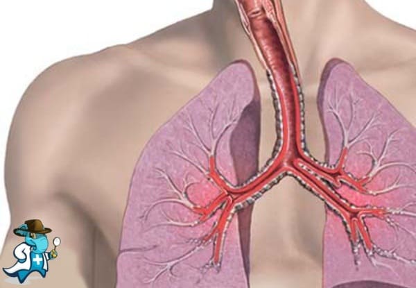 ¿Cubre el Seguro Médico el Capilaritis Pulmonar Aislada en España?
