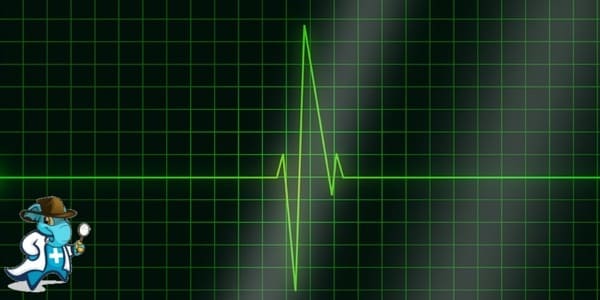 ¿Cubre el Seguro Médico la Bradicardia en España?