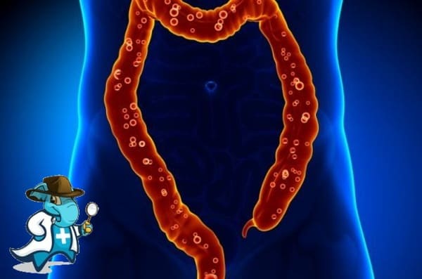 ¿Cubre el Seguro Médico la Colitis Microscópica en España?