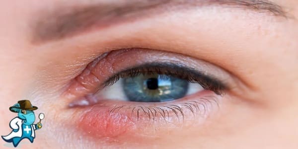 ¿Cubre el Seguro Médico la Dacrioadenitis en España?