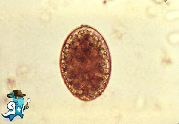 ¿Cubre el Seguro Médico la Difilobotriasis en España?