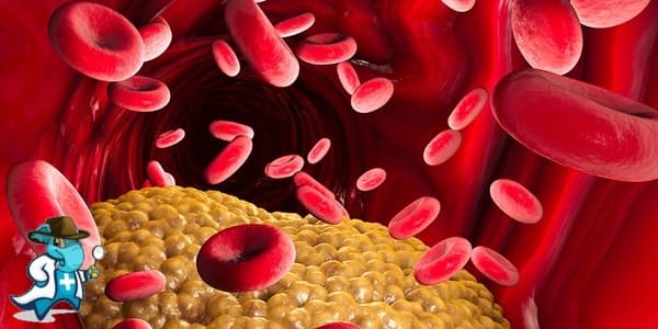 ¿Cubre el Seguro Médico la Dislipidemia Rara en España?