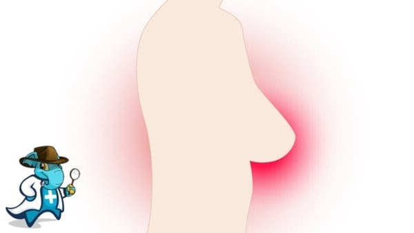 ¿Cubre el Seguro Médico la Ectasia en España?