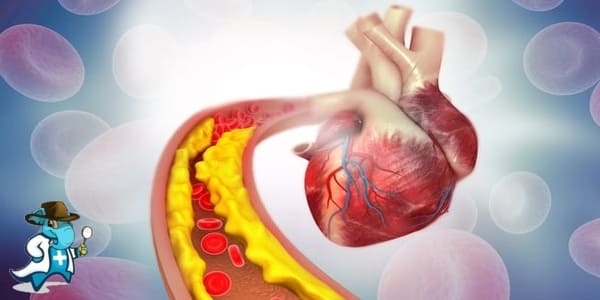 ¿Cubre el Seguro Médico la Enfermedad de las Arterias Coronarias en España?