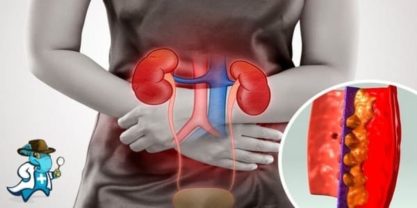 ¿Cubre el Seguro Médico la Glomerulonefritis en España?