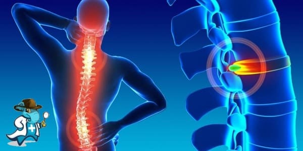 ¿Puedo Contratar un Seguro Médico si Tengo Daño de la Médula Espinal en España?