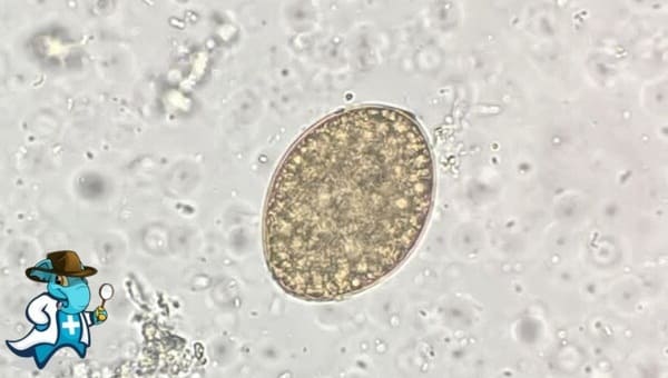 ¿Puedo Contratar un Seguro Médico si Tengo Difilobotriasis en España?