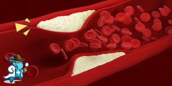 ¿Puedo Contratar un Seguro Médico si Tengo Dislipidemia Rara en España?