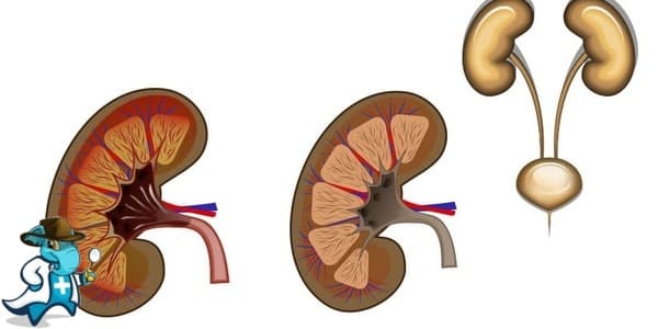¿Puedo Contratar un Seguro Médico si Tengo Glomerulonefritis en España?