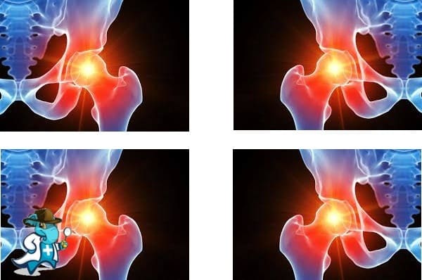 ¿Puedo Contratar un Seguro Médico si Tengo Osteomielitis en España?
