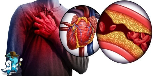 ¿Puedo Contratar un Seguro Médico si Tengo la Enfermedad de las Arterias Coronarias en España?