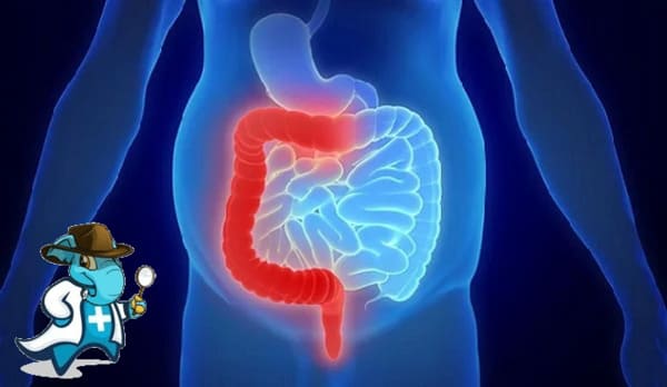 ¿Puedo Ocultar que Tengo Colitis Microscópica Para Contratar el Seguro Médico en España?