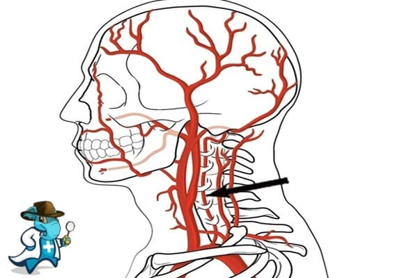 ¿Puedo Ocultar que Tengo Disección Arterial Cervical para Contratar el Seguro Médico en España?