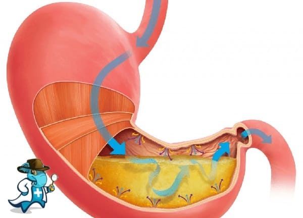 ¿Puedo Ocultar que Tengo Gastroparesia Para Contratar el Seguro Médico en España?