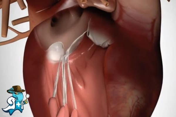 ¿Puedo Ocultar que Tengo Insuficiencia de la Válvula Mitral para Contratar el Seguro Médico en España?