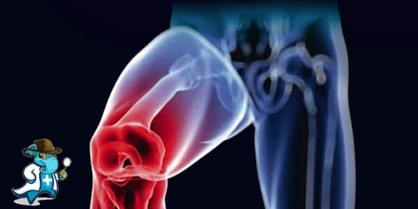¿Puedo Ocultar que Tengo Osteomielitis Para Contratar el Seguro Médico en España?