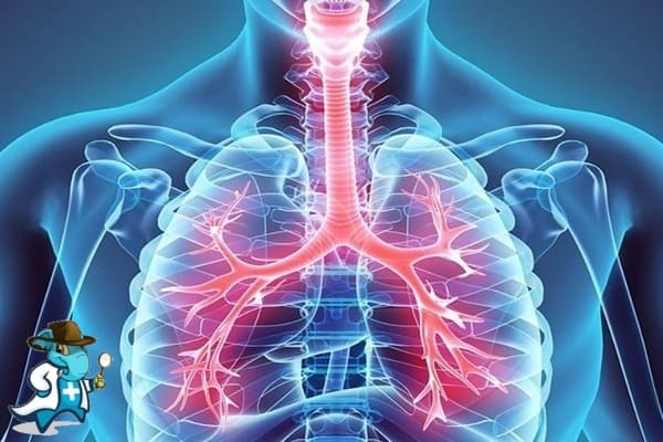 ¿Puedo Ocultar que Tengo Trombo Embolismo Pulmonar para Contratar el Seguro Médico en España?