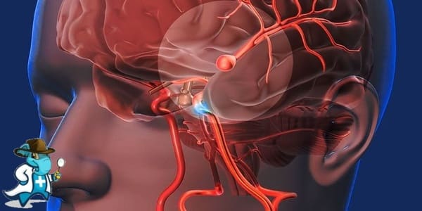¿Puedo contratar un seguro médico si tengo la Enfermedad cerebrovascular en España?