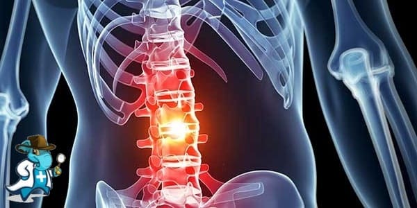 ¿Cubre el Seguro Médico el Daño de la Médula Espinal en España?
