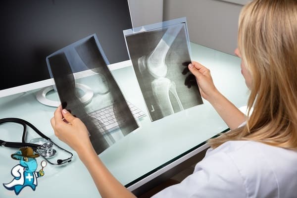 ¿Cubre el Seguro Médico la Acidemia Propiónica en España?