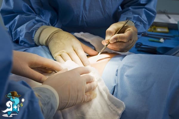 ¿Puedo Contratar un Seguro Médico si Tengo Adenocarcinoma Cervical en España?