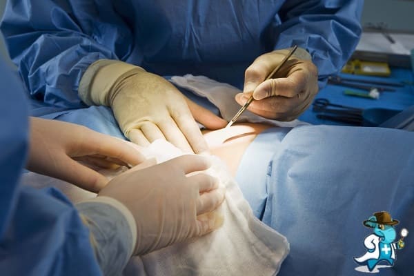 ¿Puedo Contratar un Seguro Médico si Tengo Adenocarcinoma del Pene en España?