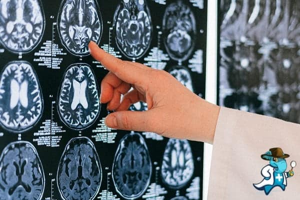 ¿Puedo Ocultar que Tengo Aceruloplasminemia para Contratar el Seguro Médico en España?