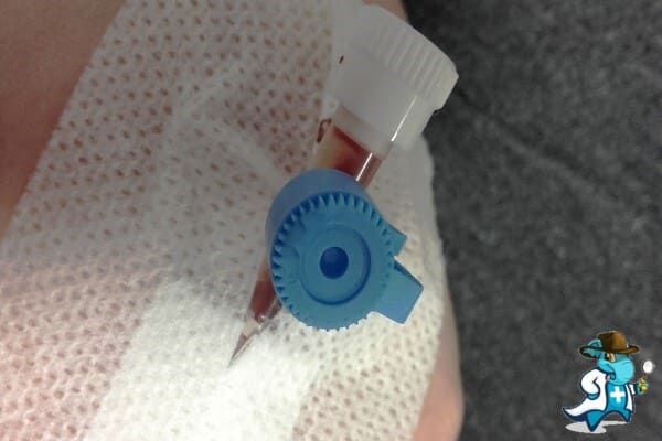 ¿Puedo Ocultar que Tengo Balantidiasis para Contratar el Seguro Médico en España?