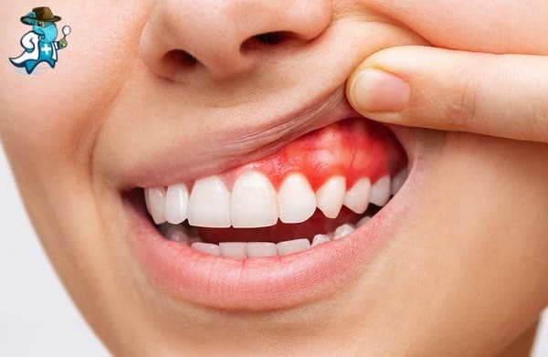 Encías Y Periodoncia en la Clínica Dental Álava