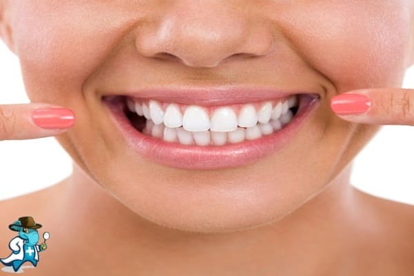 Blanqueamiento Dental Clínica Dental Tiz-Tuz en Álava 